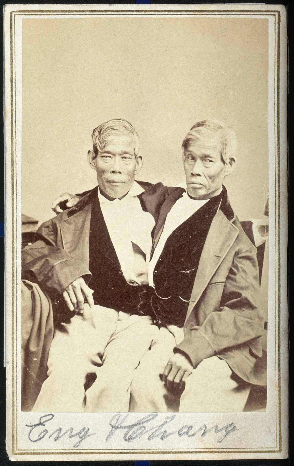 Chang and Eng Bunker