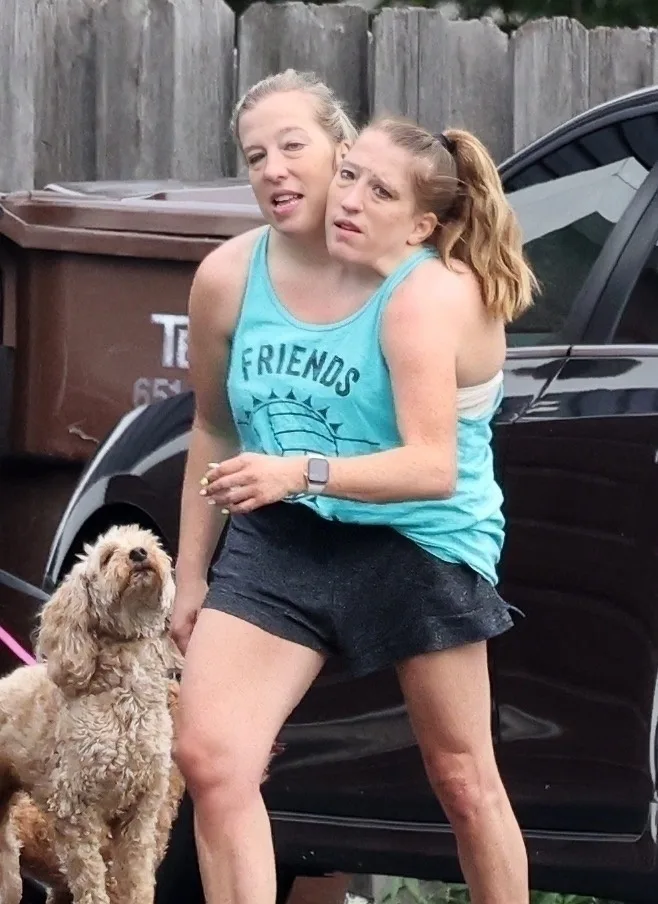 Abby and Brittany Hensel