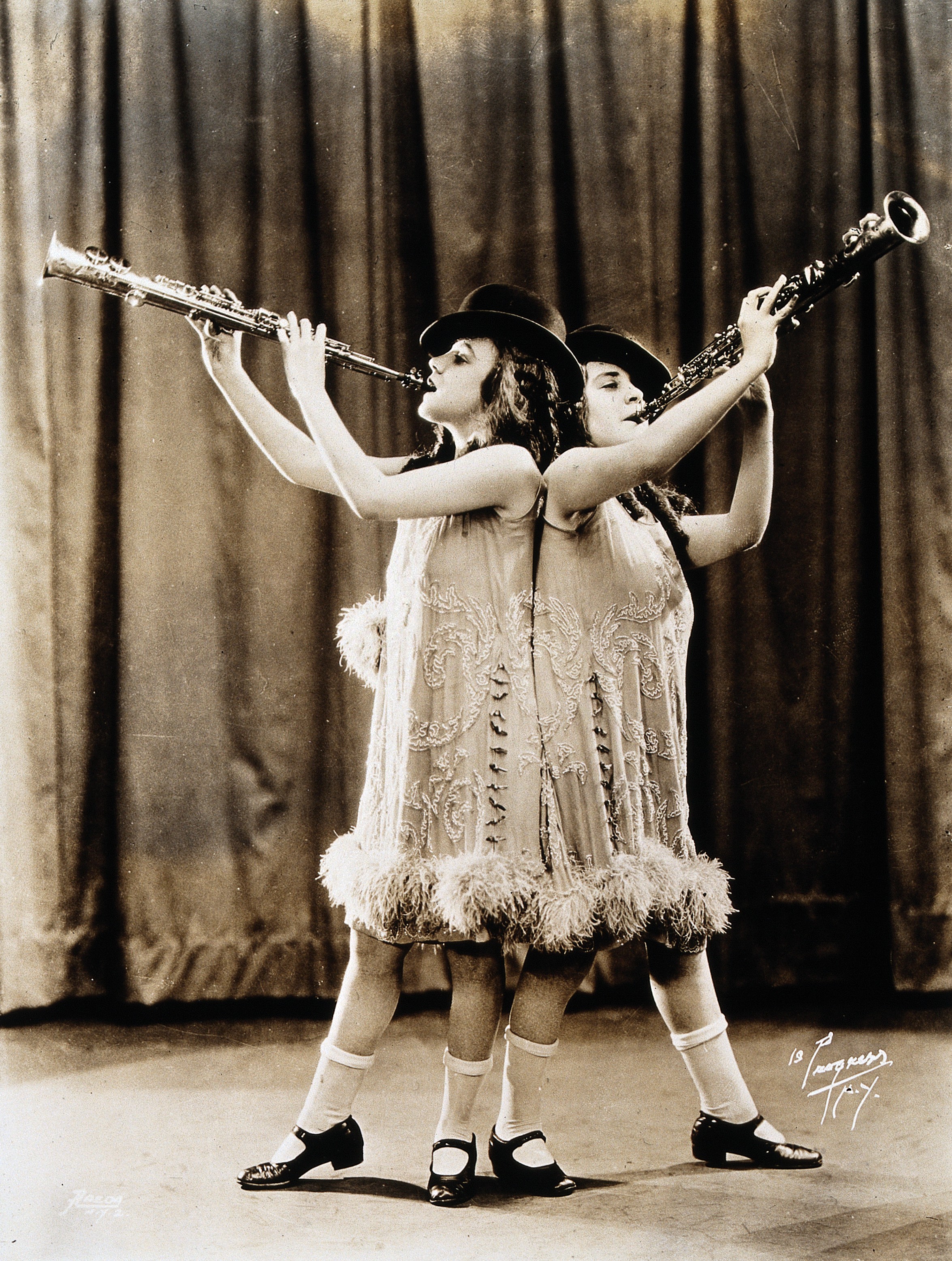 Daisy and Violet Hilton